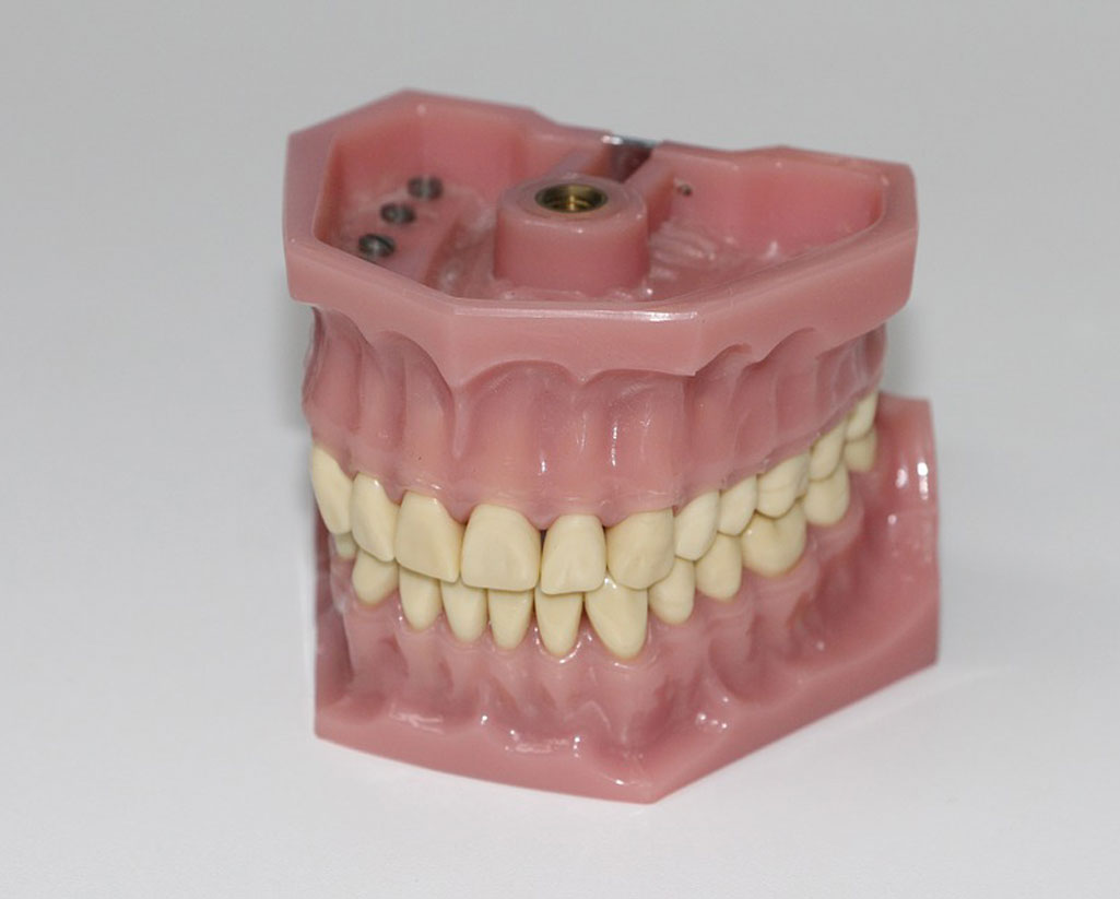 Protesi dentaria